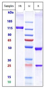 Omalizumab Humanized Antibody in SDS-PAGE (SDS-PAGE)