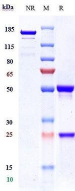 ITGAV/ITGB3 (Etaracizumab Biosimilar) Antibody in SDS-PAGE (SDS-PAGE)
