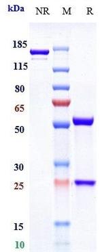 LINGO1 (Opicinumab Biosimilar) Recombinant Human Monoclonal Antibody