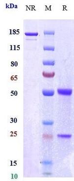 IL-17A (Orilanolimab Biosimilar) Antibody in SDS-PAGE (SDS-PAGE)