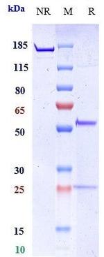 MMP-9 Biosimilar Recombinant Human Monoclonal Antibody