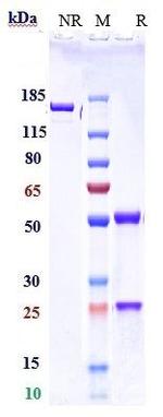 PD-1 (CD279) (Serplulimab Biosimilar) Antibody in SDS-PAGE (SDS-PAGE)