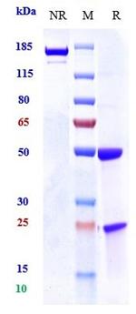 Prolactin Receptor (Biosimilar) Antibody in SDS-PAGE (SDS-PAGE)