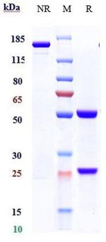beta Amyloid (Biosimilar) Antibody in SDS-PAGE (SDS-PAGE)