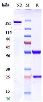 Nogo-A Biosimilar Recombinant Human Monoclonal Antibody
