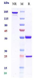 BST-2 (CD317) (Biosimilar) Recombinant Human Monoclonal Antibody