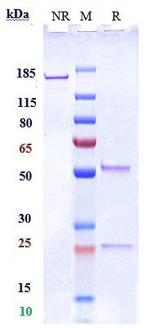 SIGLEC15 Biosimilar Antibody in SDS-PAGE (SDS-PAGE)