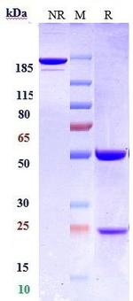 CD22 (Biosimilar) Recombinant Human Monoclonal Antibody