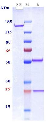 CD19 (Coltuximab Biosimilar) Antibody in SDS-PAGE (SDS-PAGE)