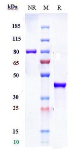 SLC2A8 Biosimilar Recombinant Human Monoclonal Antibody