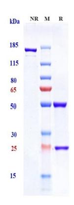beta Amyloid (Solanezumab Biosimilar) Antibody in SDS-PAGE (SDS-PAGE)