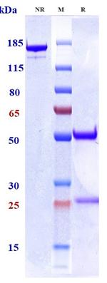 GM-CSF (Biosimilar) Antibody in SDS-PAGE (SDS-PAGE)
