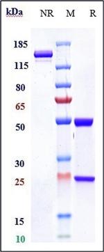 beta Amyloid Biosimilar Antibody in SDS-PAGE (SDS-PAGE)