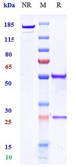 TM7SF4 Biosimilar Recombinant Human Monoclonal Antibody