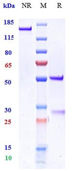 MICB Biosimilar Antibody in SDS-PAGE (SDS-PAGE)