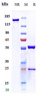 TNF alpha (Biosimilar) Antibody in SDS-PAGE (SDS-PAGE)