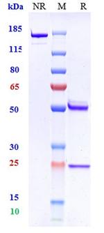 beta Amyloid (Biosimilar) Antibody in SDS-PAGE (SDS-PAGE)