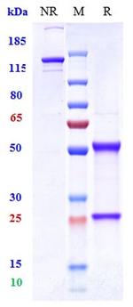 Vandortuzumab Humanized Antibody in SDS-PAGE (SDS-PAGE)