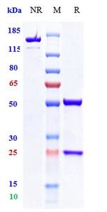 TIGIT (Vibostolimab Biosimilar) Antibody in SDS-PAGE (SDS-PAGE)