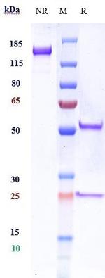 TrkB Humanized Biosimilar Recombinant Human Monoclonal Antibody