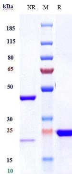 VEGF (Biosimilar) Recombinant Humanized mouse Monoclonal Antibody