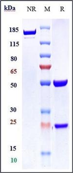 FLK1 (VEGF Receptor 2) (Biosimilar) Recombinant Human Monoclonal Antibody