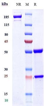 beta Amyloid (Lecanemab Biosimilar) Antibody in SDS-PAGE (SDS-PAGE)