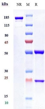 IFNAR1 (Biosimilar) Antibody in SDS-PAGE (SDS-PAGE)