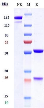 Tezepelumab Antibody in SDS-PAGE (SDS-PAGE)