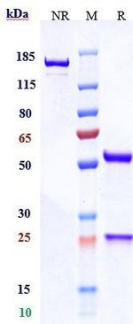 CDH17 Biosimilar Antibody in SDS-PAGE (SDS-PAGE)