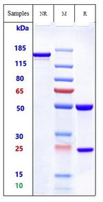 ROR2 (Ozuriftamab Biosimilar) Antibody in SDS-PAGE (SDS-PAGE)