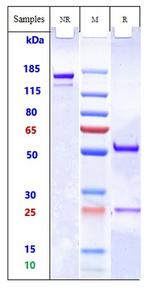 MRC2 Biosimilar Recombinant Human Monoclonal Antibody