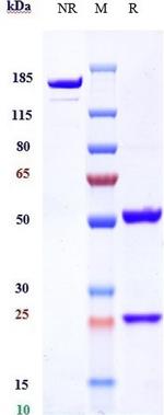 Transferrin Receptor/Iduronate 2 Sulfatase (Pabinafusp Alfa Biosimilar) Antibody in SDS-PAGE (SDS-PAGE)
