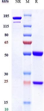CD155 Biosimilar Antibody in SDS-PAGE (SDS-PAGE)