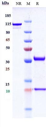 CD36 (Biosimilar) Recombinant Human Monoclonal Antibody