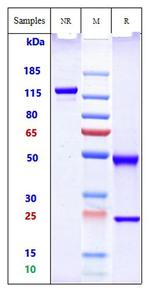Placental Alkaline Phosphatase Biosimilar Recombinant Human Monoclonal Antibody