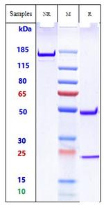 TREM2 (Biosimilar) Antibody in SDS-PAGE (SDS-PAGE)