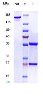 NAMPT (Biosimilar) Recombinant Human Monoclonal Antibody