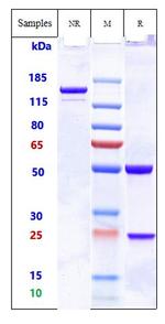 ADAM9 Humanized Biosimilar Antibody in SDS-PAGE (SDS-PAGE)