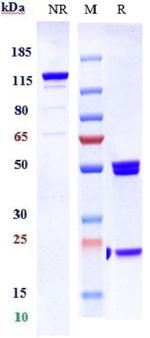 Angiopoietin 2/VEGF (Vanucizumab Biosimilar) Antibody in SDS-PAGE (SDS-PAGE)