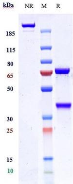 IL-17A/TNF alpha (Remtolumab Biosimilar) Antibody in SDS-PAGE (SDS-PAGE)