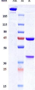 IL-1 alpha/beta (Lutikizumab Biosimilar) Antibody in SDS-PAGE (SDS-PAGE)