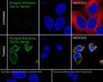 Phospho-IkB alpha (Ser32, Ser36) Antibody in Immunocytochemistry (ICC/IF)