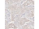 Phospho-IkB alpha (Ser32, Ser36) Antibody in Immunohistochemistry (Paraffin) (IHC (P))