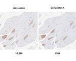 MYH7 Antibody in Immunohistochemistry (Paraffin) (IHC (P))