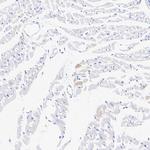 MYH7 Antibody in Immunohistochemistry (Paraffin) (IHC (P))