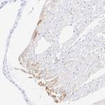 MYH7 Antibody in Immunohistochemistry (Paraffin) (IHC (P))