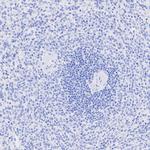 MYH7 Antibody in Immunohistochemistry (Paraffin) (IHC (P))