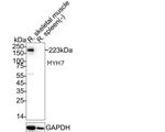 MYH7 Antibody in Western Blot (WB)