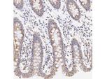 MTCO1 Antibody in Immunohistochemistry (Paraffin) (IHC (P))